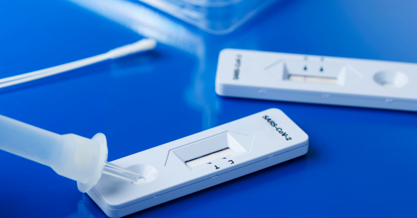 Espanha libera venda de testes de antígenos sem receita médica